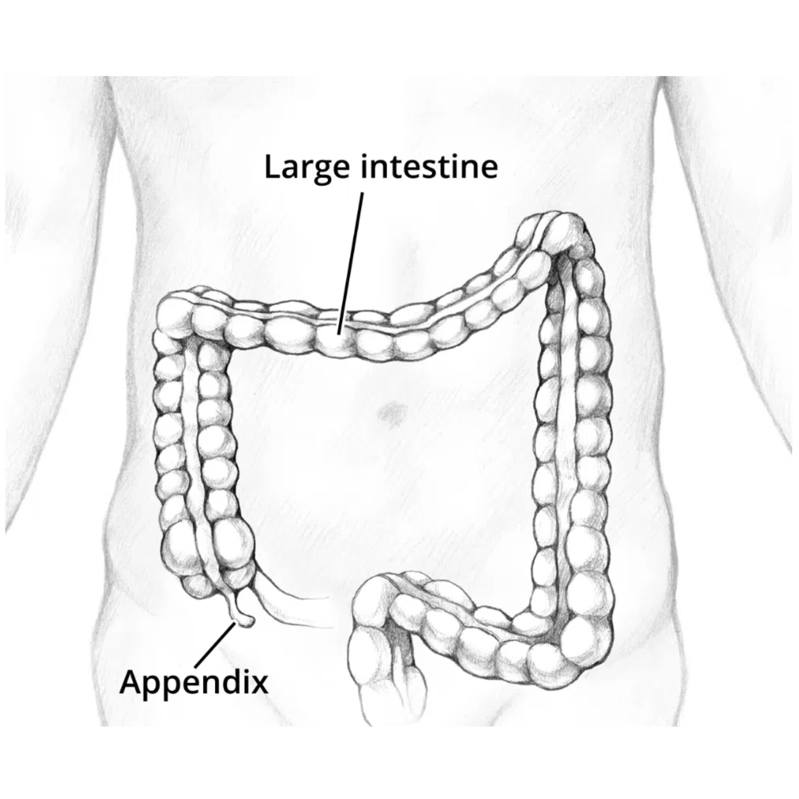 Appendicitis