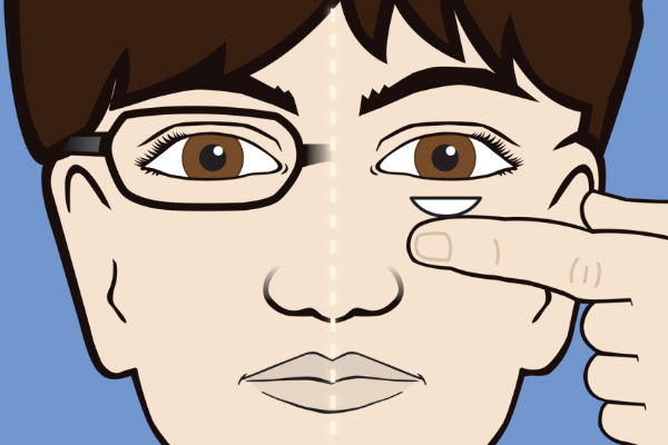 What To Know If Your Child Wants Contact Lenses